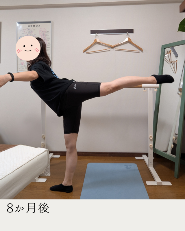 after画像
