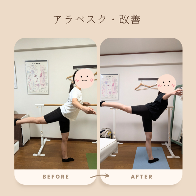 大人バレエ・アラベスクの改善