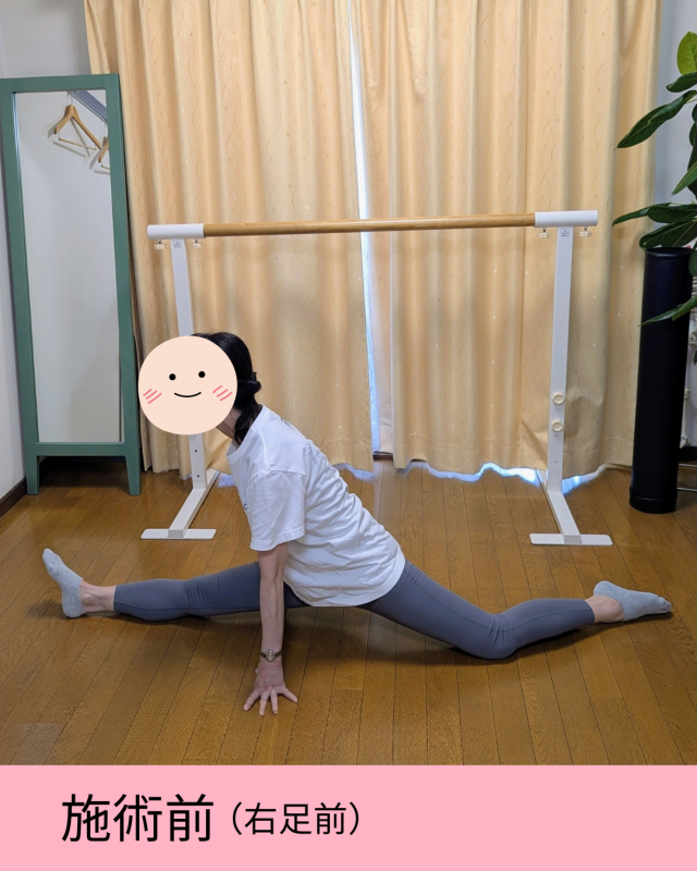 before画像
