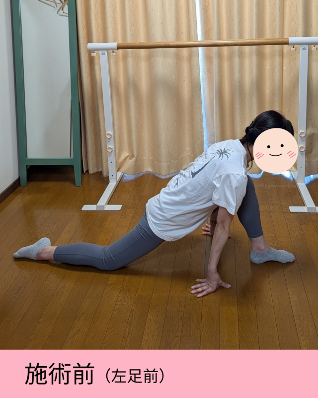 before画像